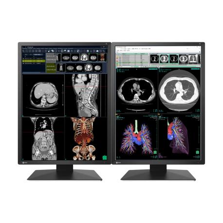 EIZO RadiForce RX270 - LCD monitor - 2MP - colour - 21.3" - 1200 x 1600 - IPS - 1000 cd / m² - 1800:1 - 20 ms - DVI-D, 2xDisplayPort - black - 4