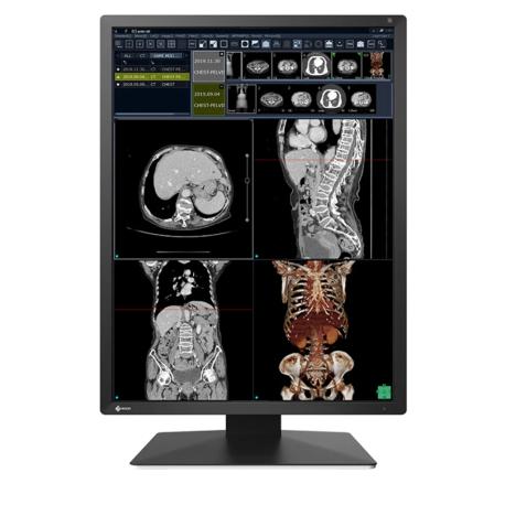 EIZO RadiForce RX270 - LCD monitor - 2MP - colour - 21.3" - 1200 x 1600 - IPS - 1000 cd / m² - 1800:1 - 20 ms - DVI-D, 2xDisplayPort - black - 1